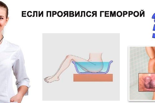 Kraken вход kraken torion